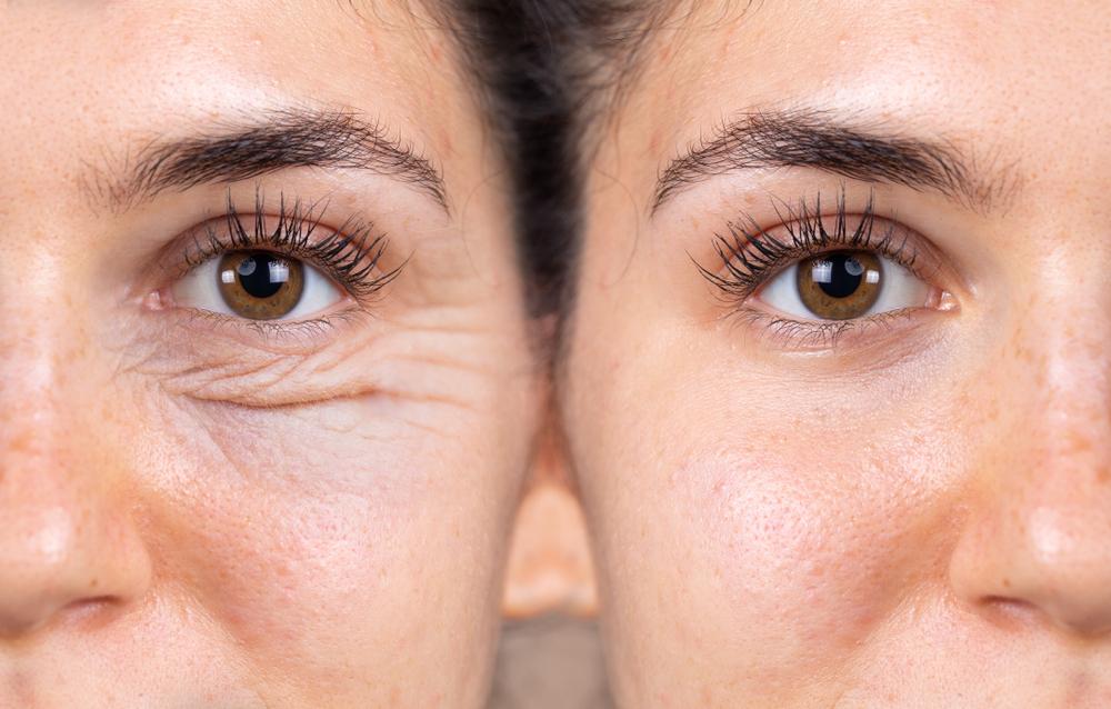 تجميل الجفون والتجميل بدون جراحة وعمليات تجميل الثدي أفضل دكتور تجميل في مصر